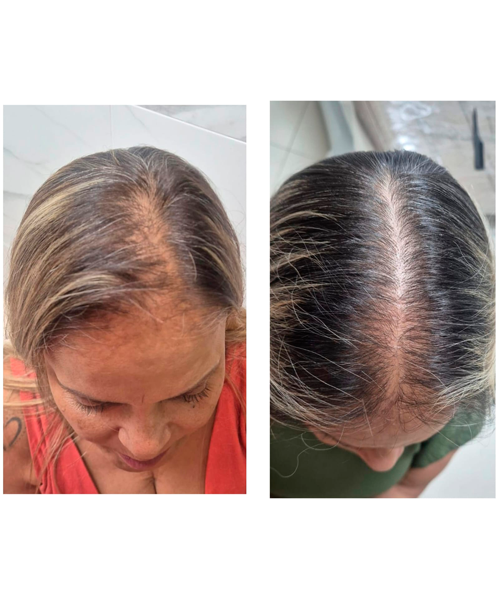 Estética capilar